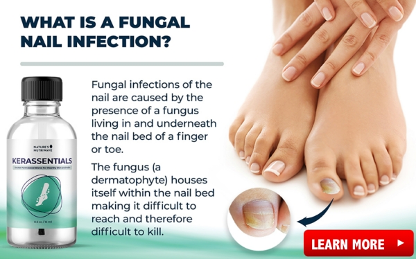 phrena fungiclear cream